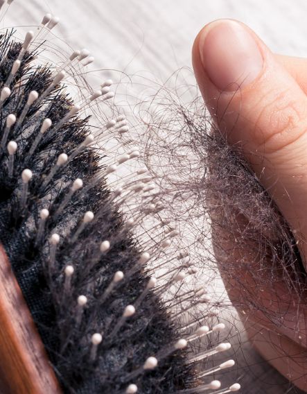 Hair loss